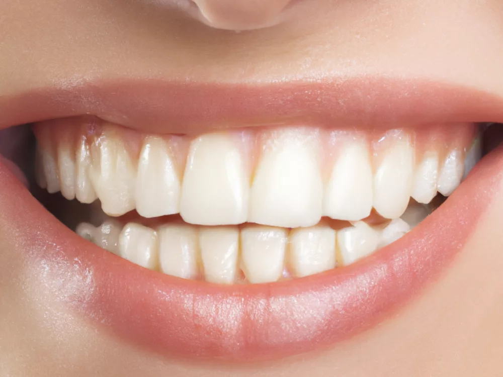 The Smile Revolution: Unpacking Celebrity Dental Implant Transformations